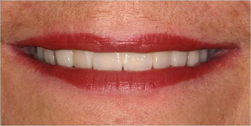 Central NJ Prosthodontics