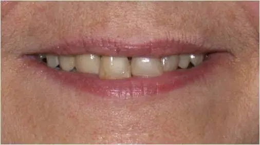 Central NJ Prosthodontics