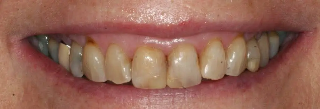 Central NJ Prosthodontics