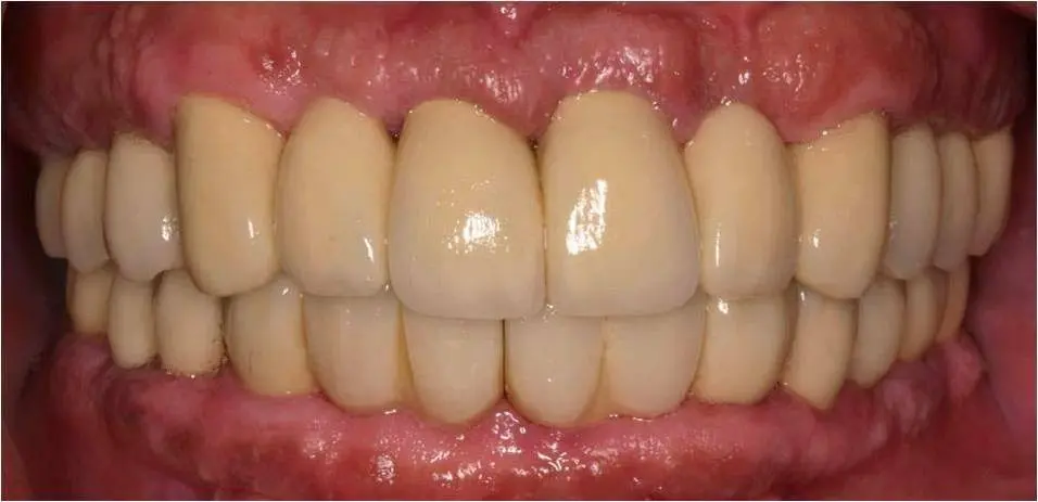 Central NJ Prosthodontics
