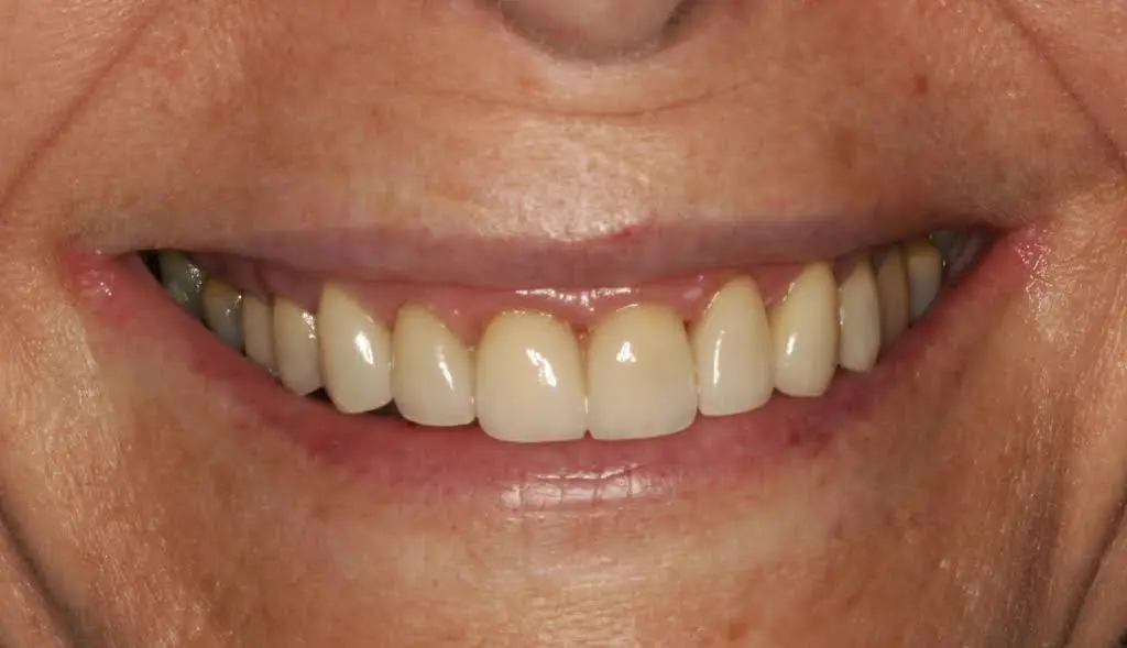 Central NJ Prosthodontics