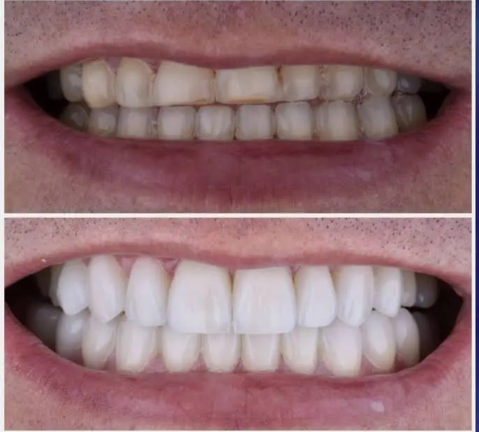 iSmile Dental Office
