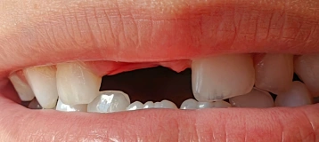 Kidco Pediatric Dentists