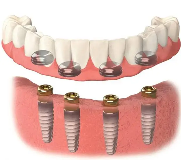 DPI Dental