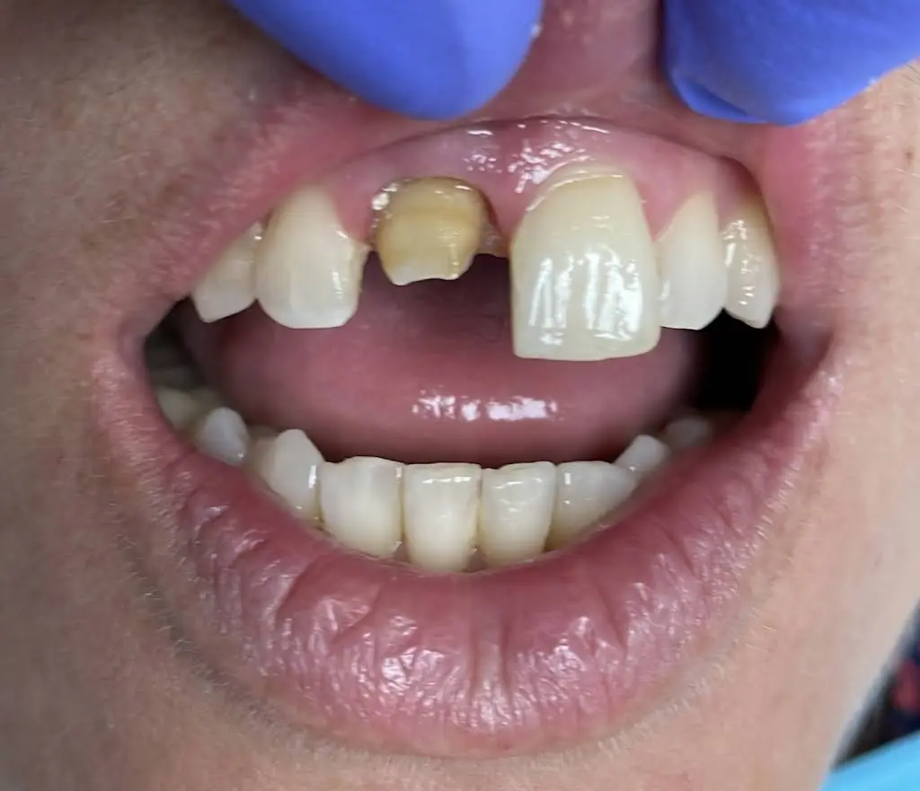 Aesthetic Dental Greenpoint Brooklyn
