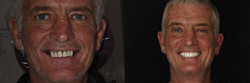 Brooklyn Heights Dental: Eugene D. Stanislaus, DDS