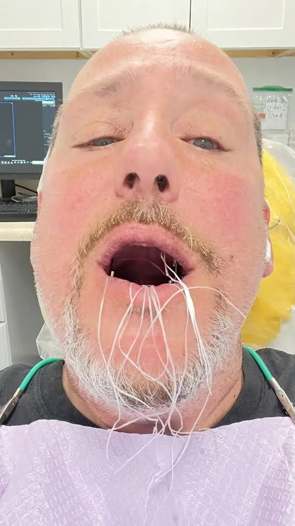 Affordable Dentures & Implants