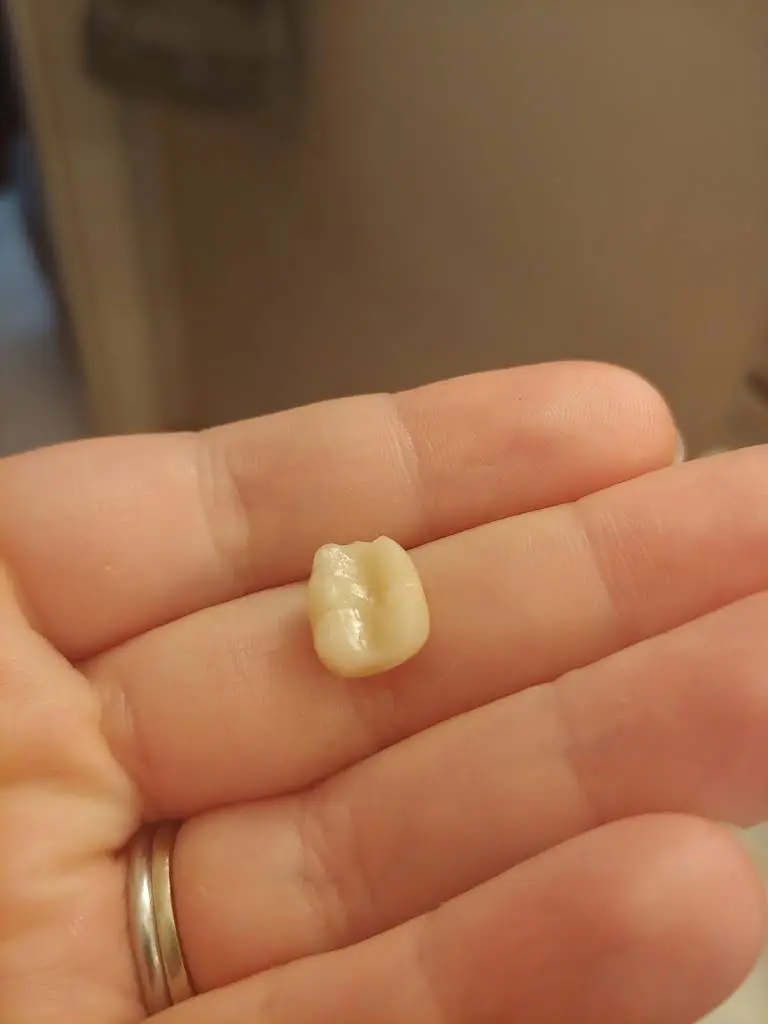 Aspen Dental