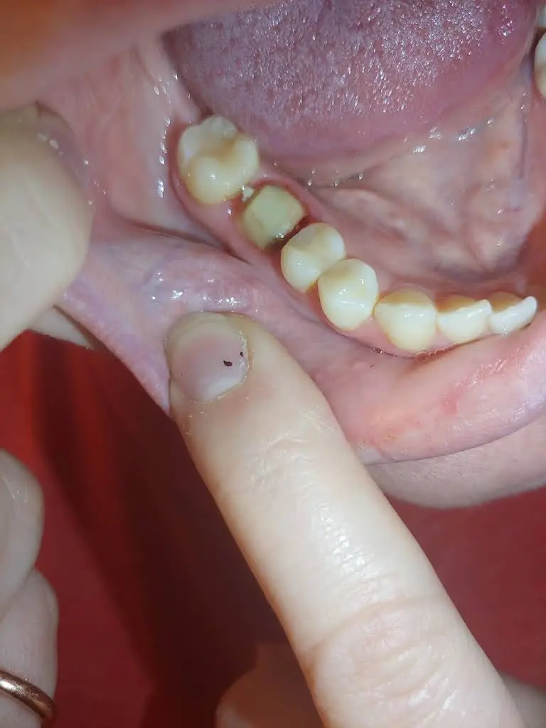 Aspen Dental