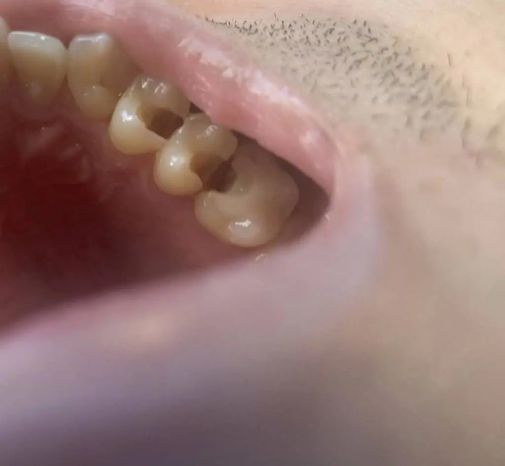 Fraser Dentistry