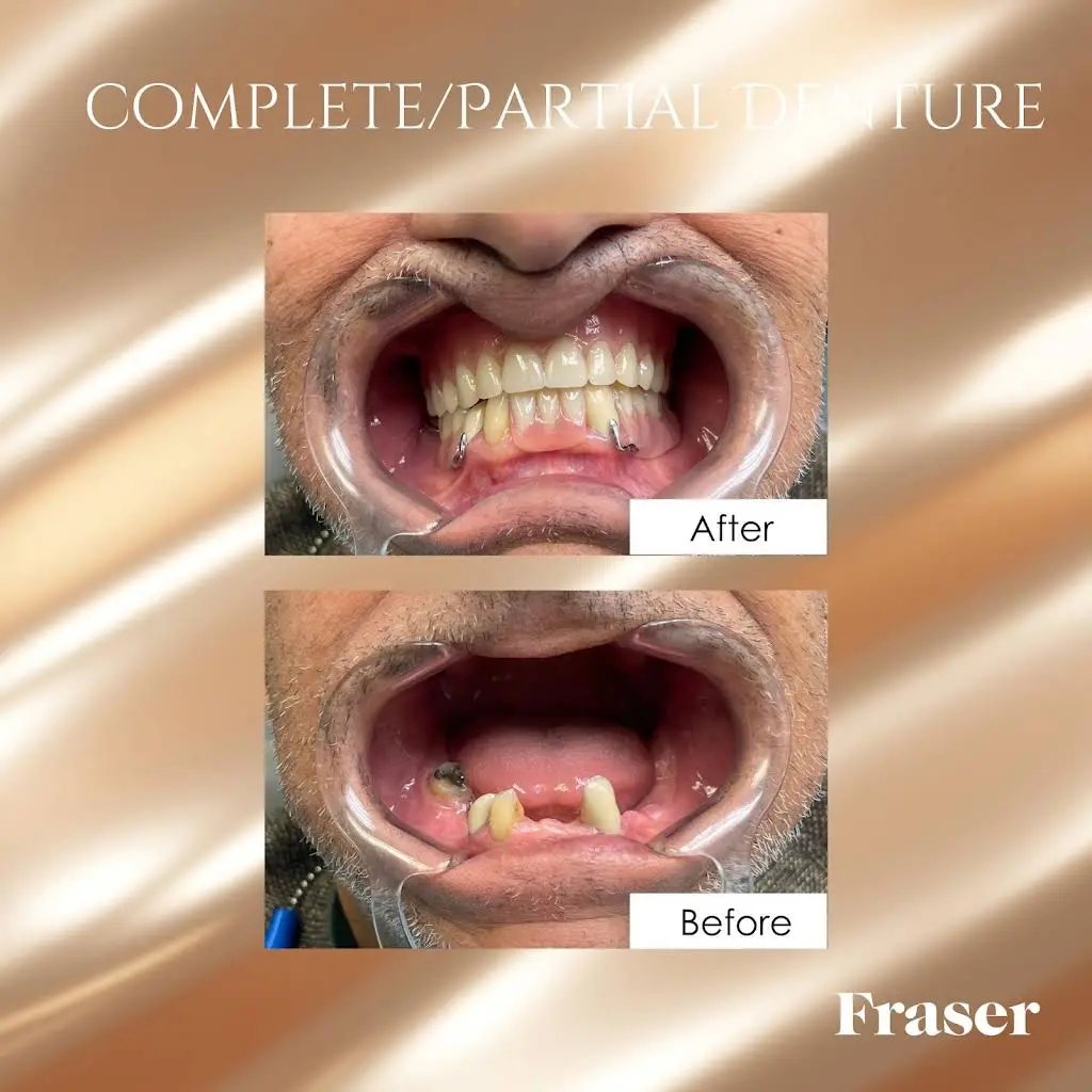 Fraser Dentistry