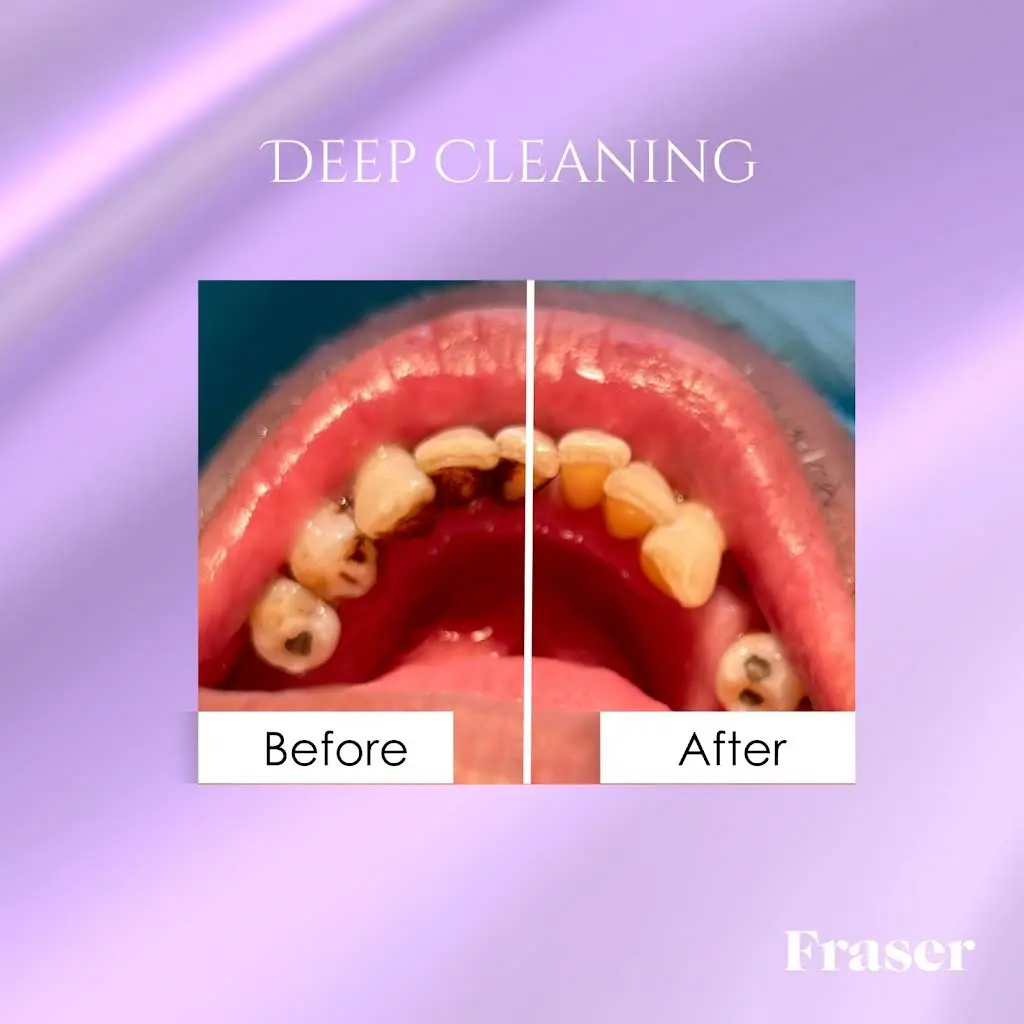 Fraser Dentistry