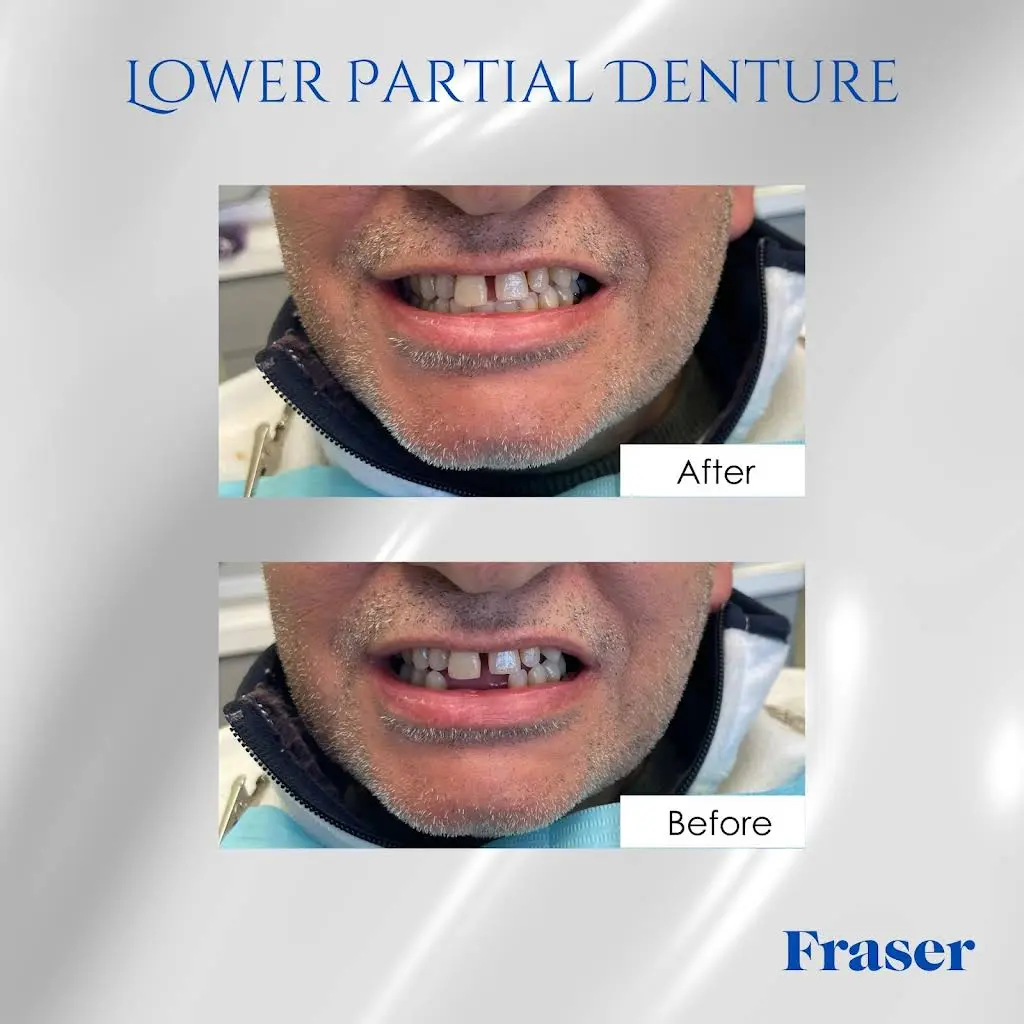 Fraser Dentistry