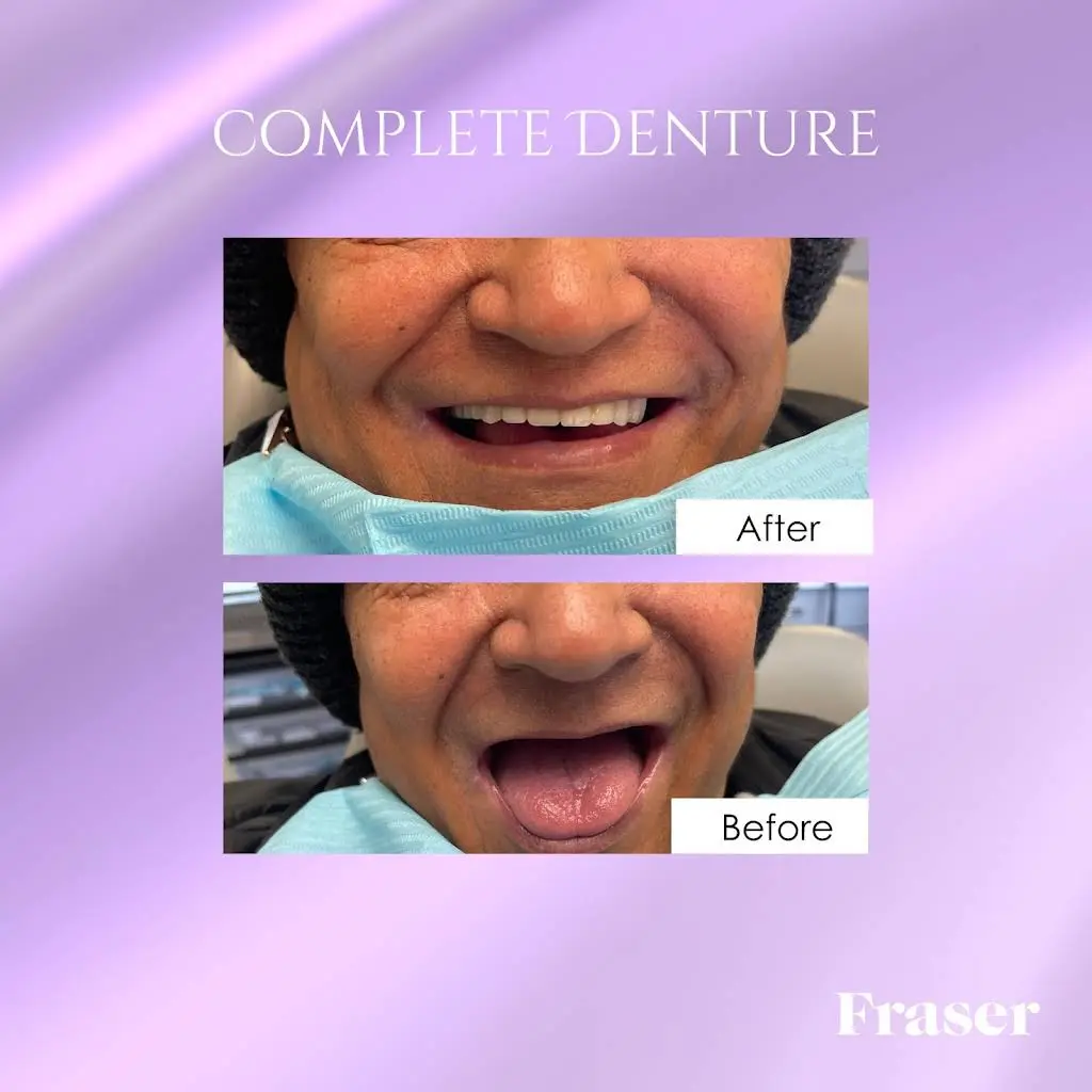 Fraser Dentistry