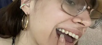 Malka Dental