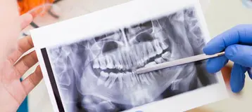 Elmora Dental Associates