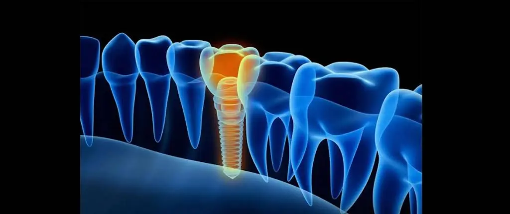 Royal Dental Group