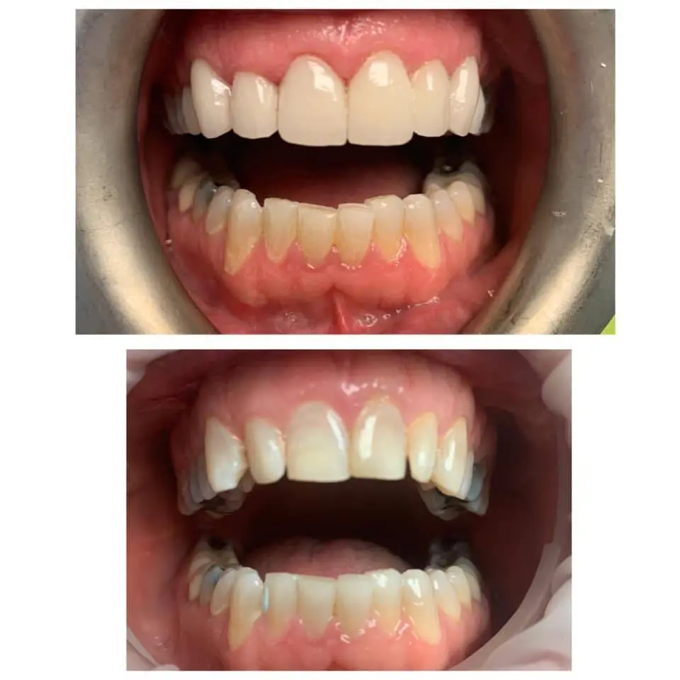 Creating Smiles Family Dental PC