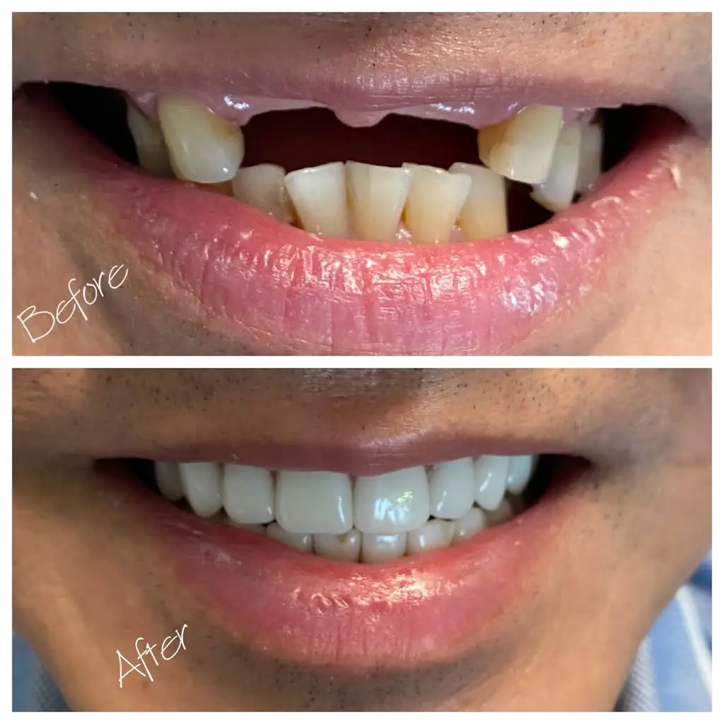 iSmile Dental Care of Bloomfield
