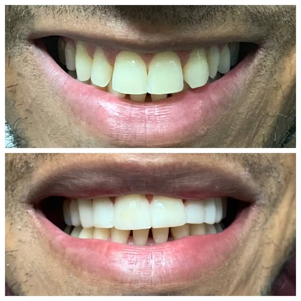 iSmile Dental Care of Bloomfield