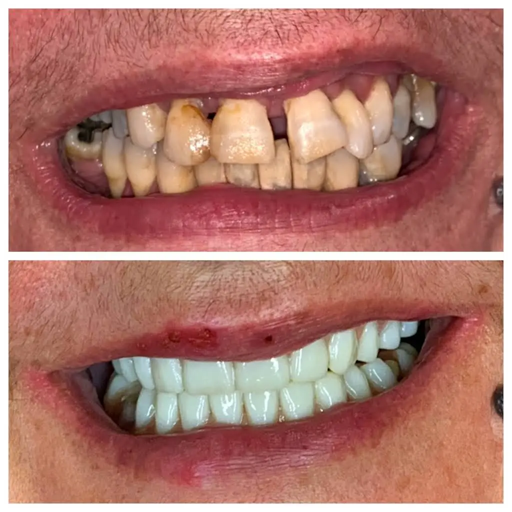 iSmile Dental Care of Bloomfield