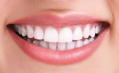 Creative Smiles