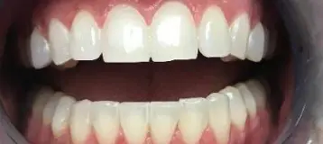 Carey Family Dentistry