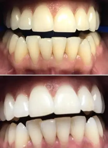 Carey Family Dentistry