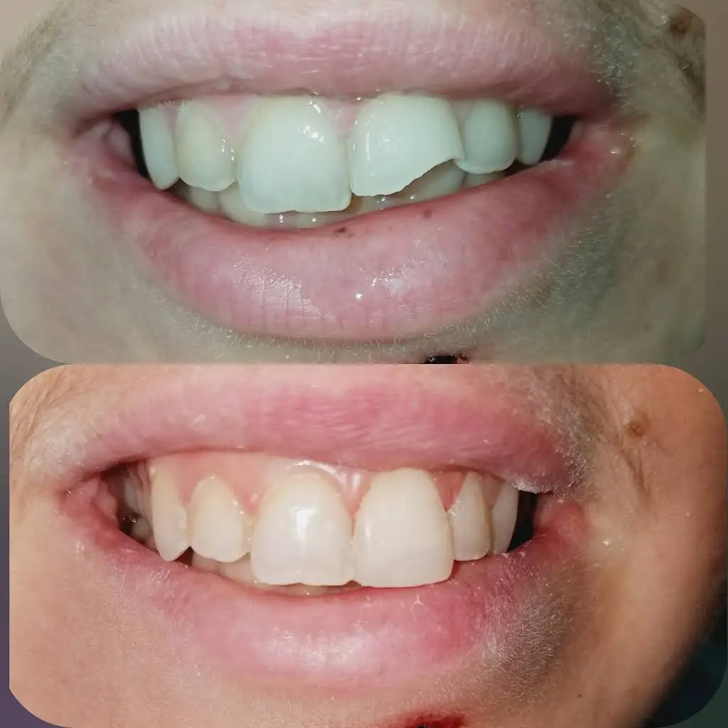Maspeth USmiles Dental Care