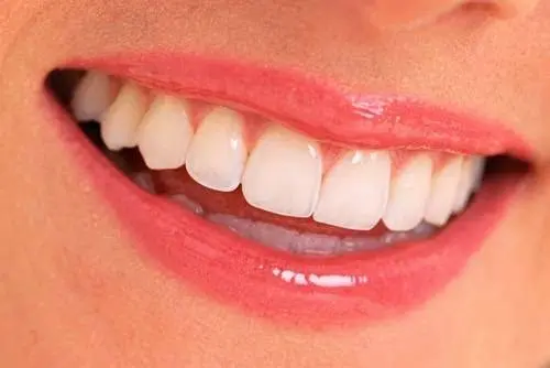 Glendale Dental Associates