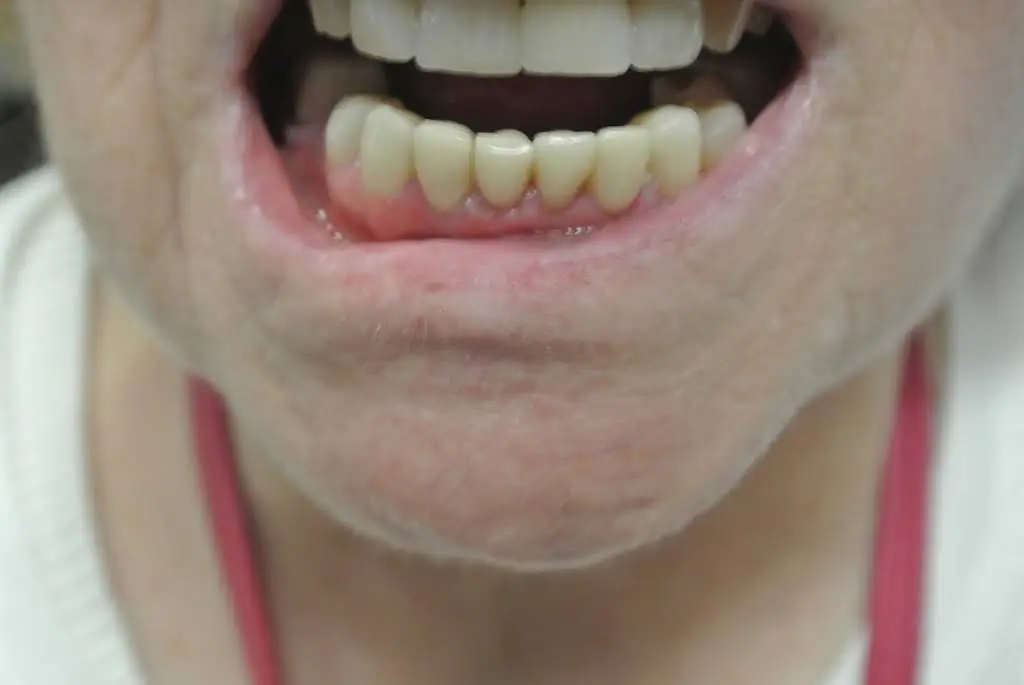 Two Bridges Dentist
