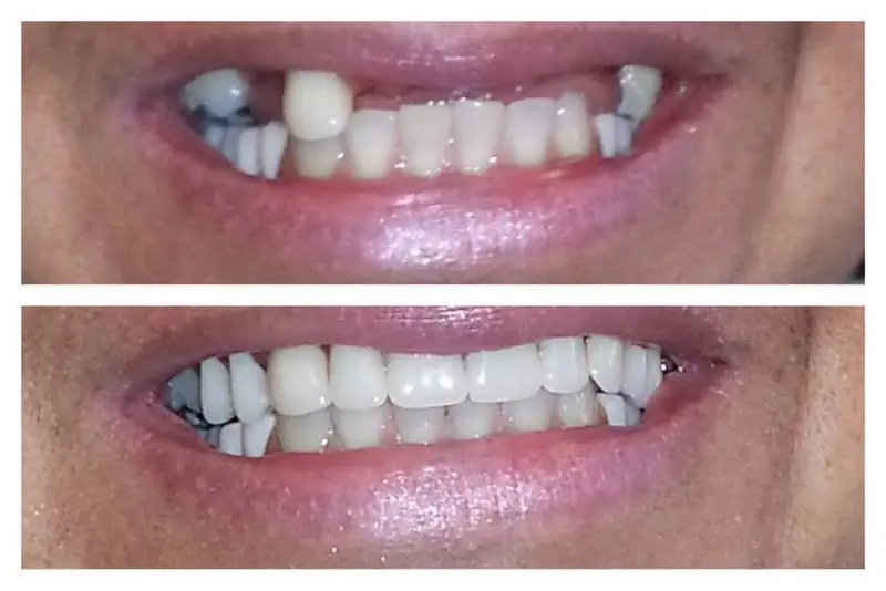 Esral Dental