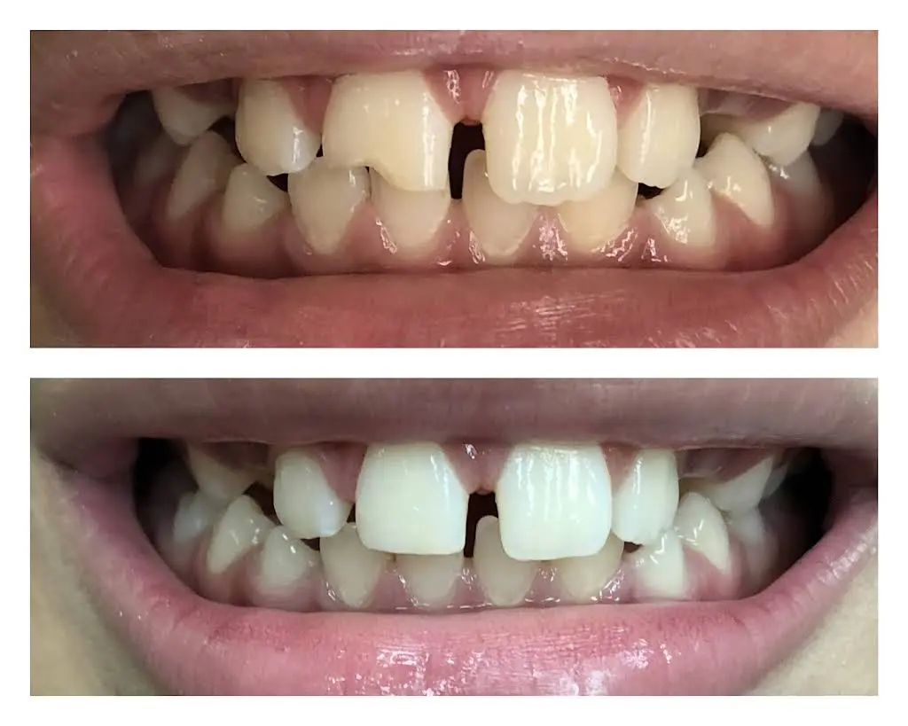 Esral Dental