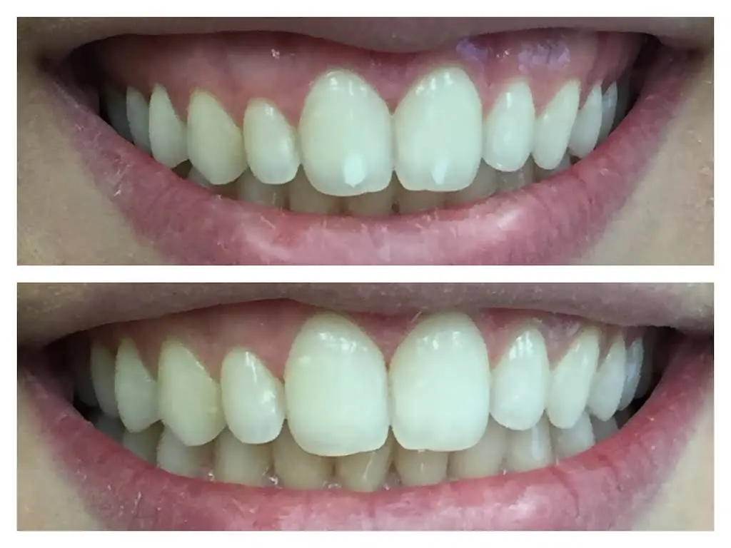 Esral Dental