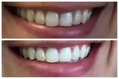 Esral Dental