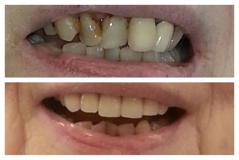 Esral Dental