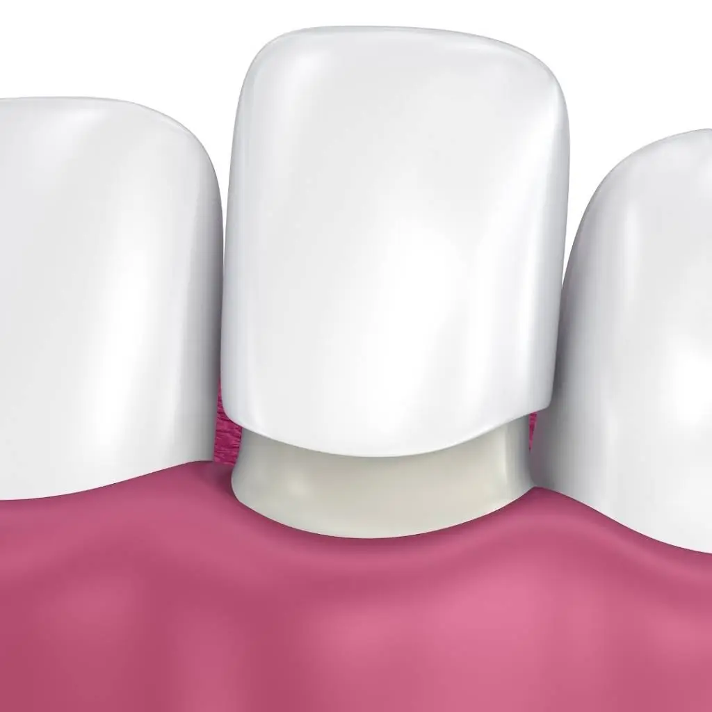 My Smile Dental