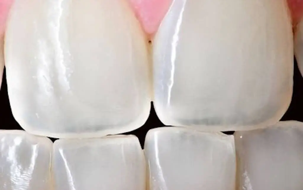 Trovato Family Laser Dentistry
