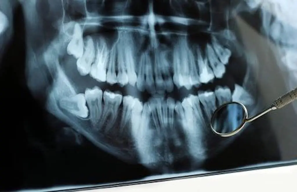 Trovato Family Laser Dentistry