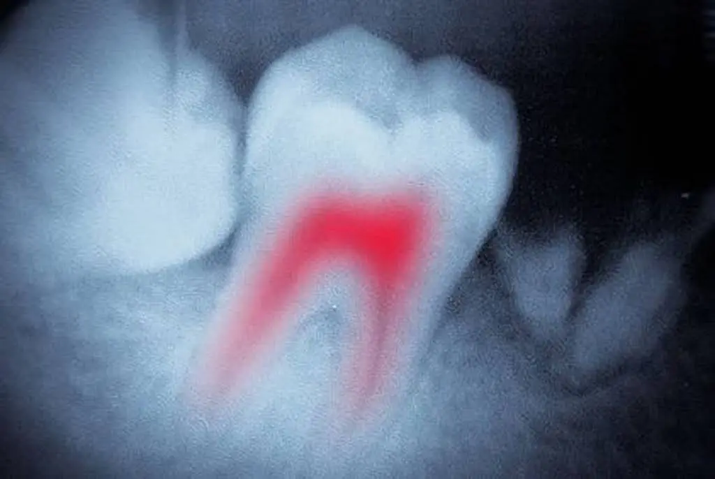Trovato Family Laser Dentistry