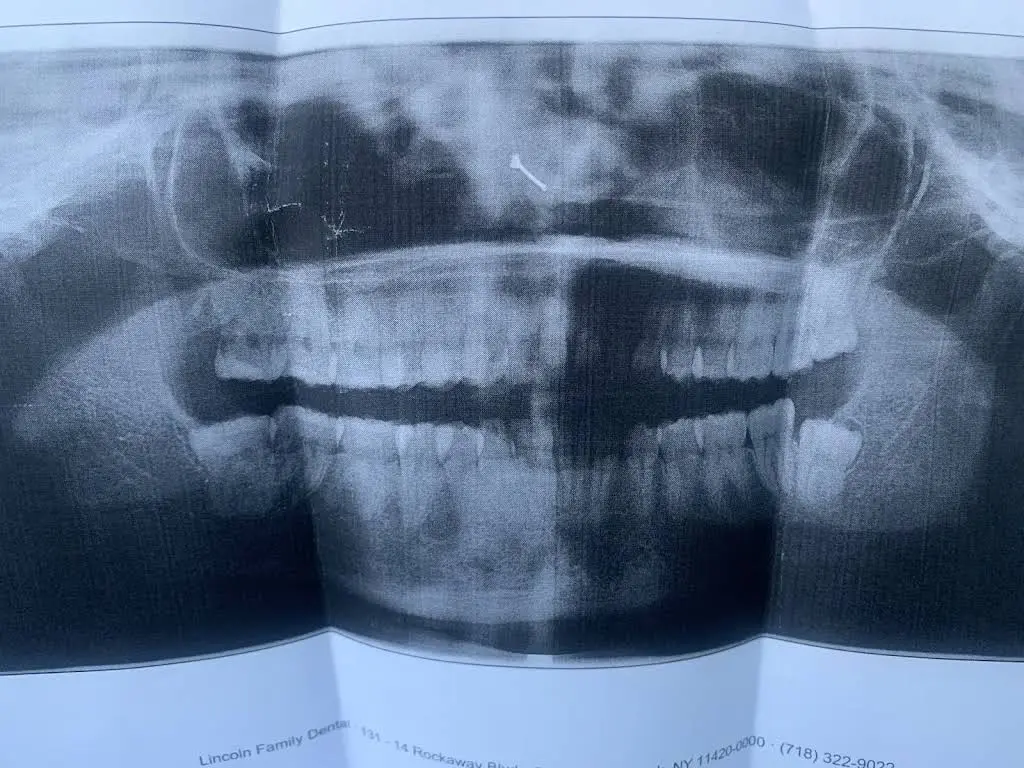 Family Dental Rego Park