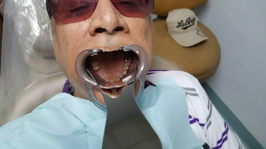Family Dental Rego Park