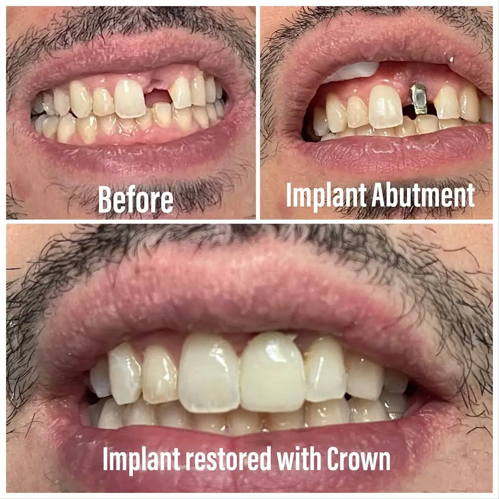 Family Dental Rego Park
