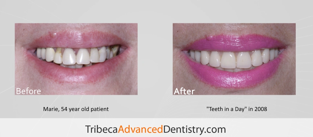 Tribeca Advanced Dentistry by Dr. Olga Malkin