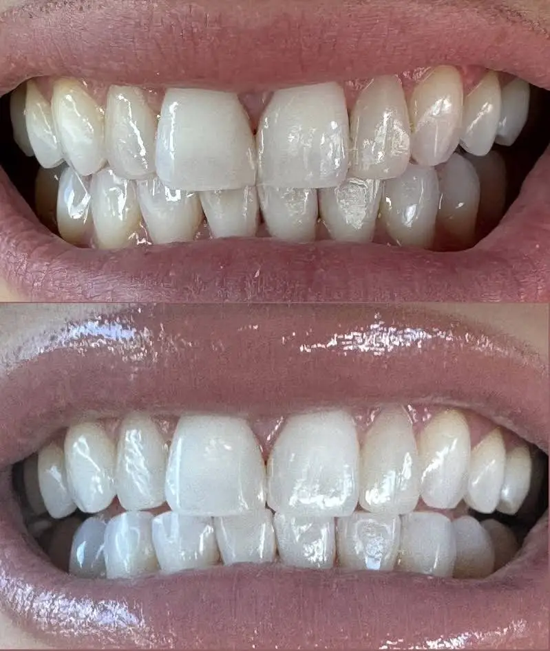 My NYC Dentist - Hudson Street Dental