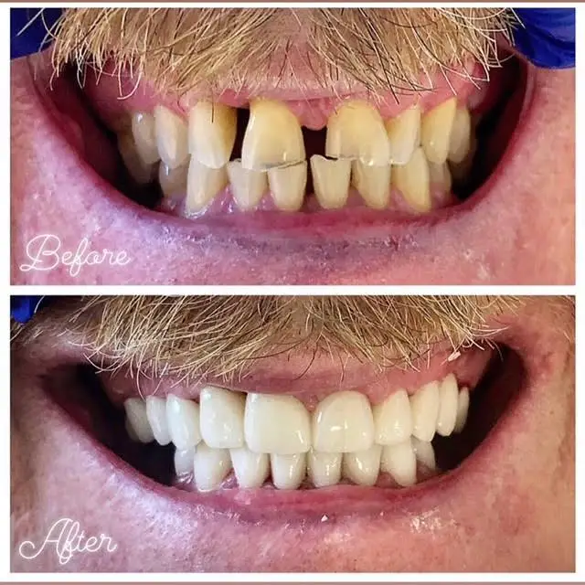Harrison Street Dental