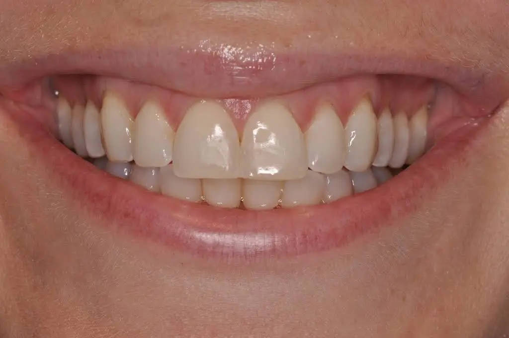 Blue Line Dental