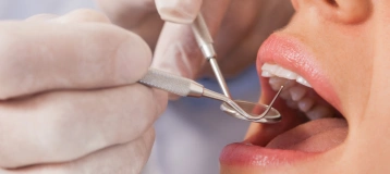 Dental Excellence