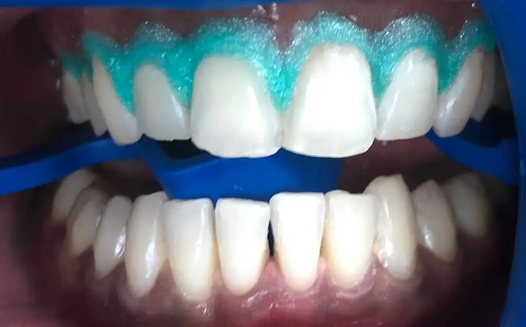 Genuine Smiles PA - Professional dental clinic exterior with modern facilities