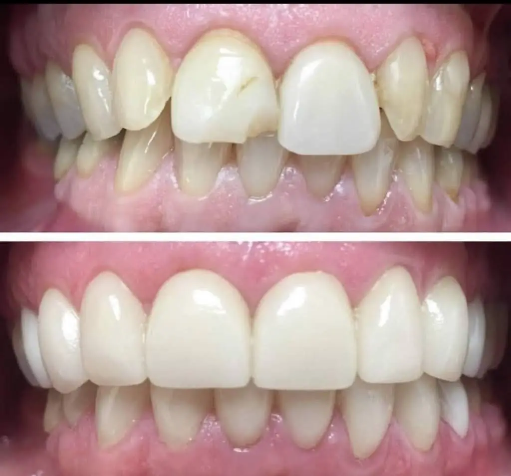 NÜVA SMILE - Professional dental clinic exterior with modern facilities